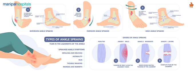 sports-injuries-rest-vs-treatment