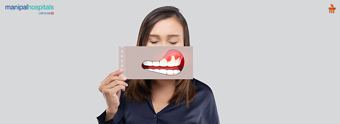 Stage 4 Oral Cancer: Symptoms and Palliative Care