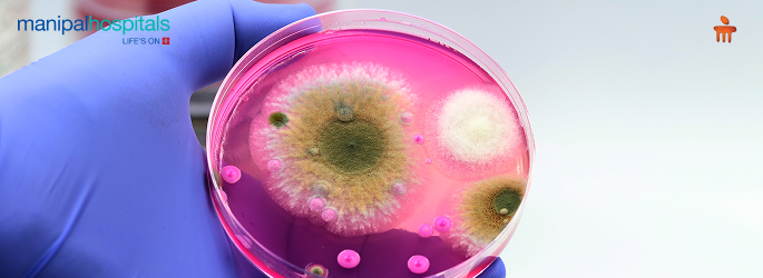 Symptoms of fungal infections