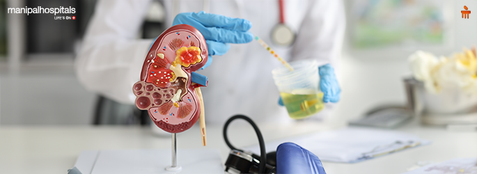 Symptoms of Kidney Stones