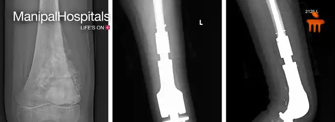 top-orthopedic-hospital-in-
