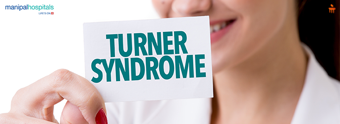 turner syndrome symptoms causes treatment