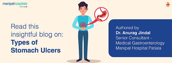 Stomach Ulcer It's Signs, Symptoms, Causes & Treatment