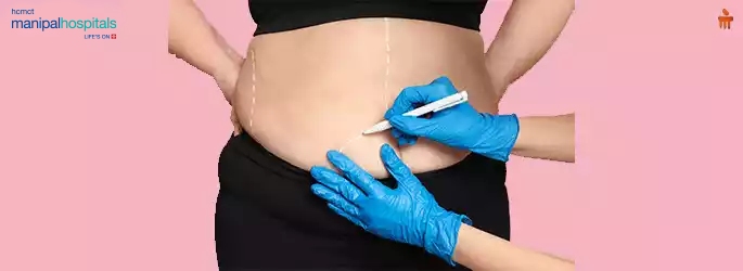 Bariatric Surgery Hospital in Delhi