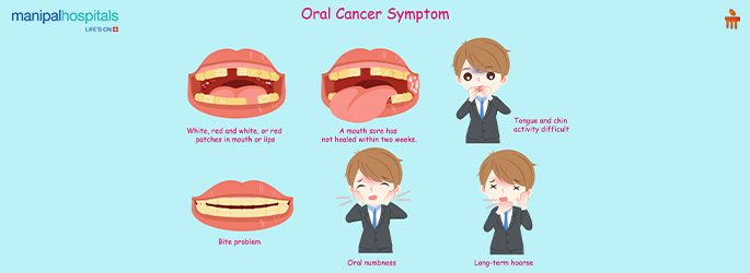 Mouth Cancer Symptoms