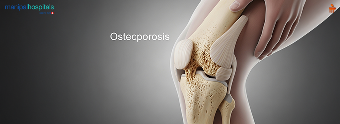 understanding-osteoporosis-causes-symptoms-prevention