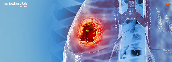 Understanding the Possibility of Curing Lung Cancer