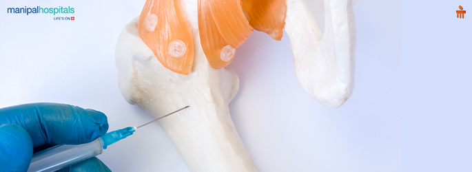 understanding Bone Biopsy: Procedure, Accuracy, Recovery Timeline & Results