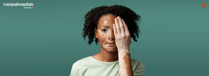 Vitiligo disease treatment and types