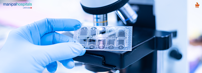 What are the uses of Urine Cytology
