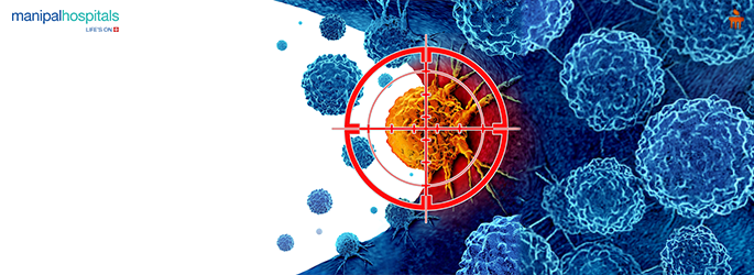 रक्त कैंसर के शुरुआती लक्षण