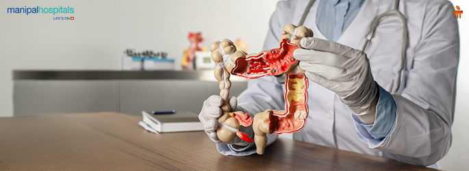 अल्सरेटिव कोलाइटिस के लक्षण