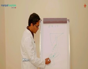 ERCP Procedure Explained