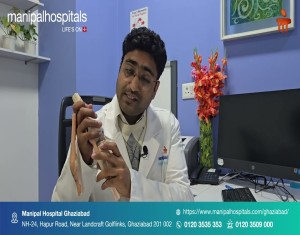 Knee Replacement | Dr. Prateek Gupta