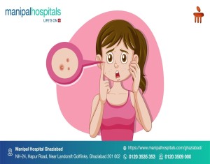 Common Dermatology and Skin Related Myths
