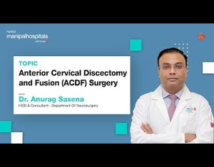 Anterior Cervical Discectomy and Fusion (ACDF) Surgery