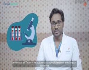 Common symptoms of colon cancer 