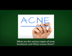 Dermatologist in Whitefield, Bangalore