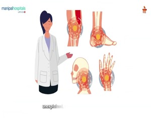 Childhood Autoimmune Diseases