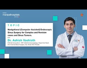 Navigational Endoscopic Sinus Surgery