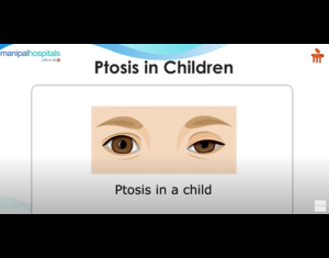 Oculoplasty and Orbital Surgeon in Varthur