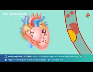 Prevalence of Heart Diseases