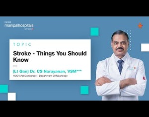 Stroke - Things You Should Know