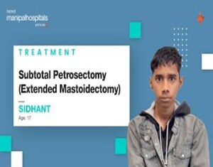 Subtotal Petrosectomy