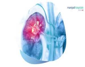 Best nephrologist in Ghaziabad