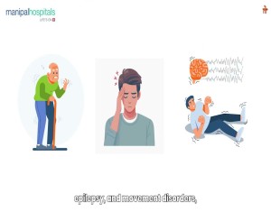 Neurology | Manipal Hospital Jayanagar
