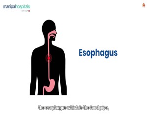 Surgical Gastroenterology | Manipal Hospital Jayanagar