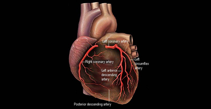 Angiogram