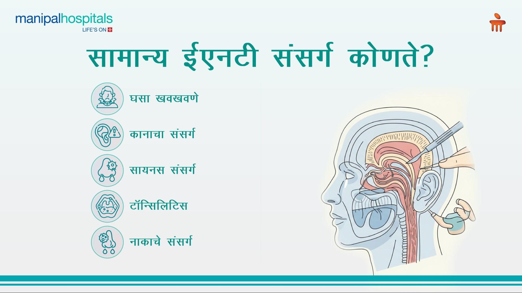 घसा खवखवणे उपचार