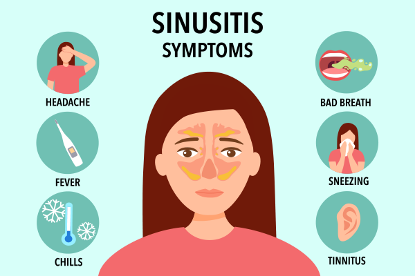 Symptoms of Sinus