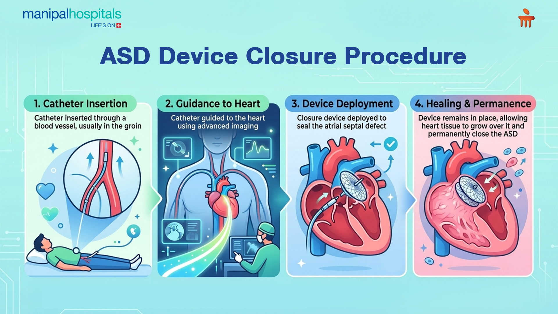 asd-device-closure-procedure-guide