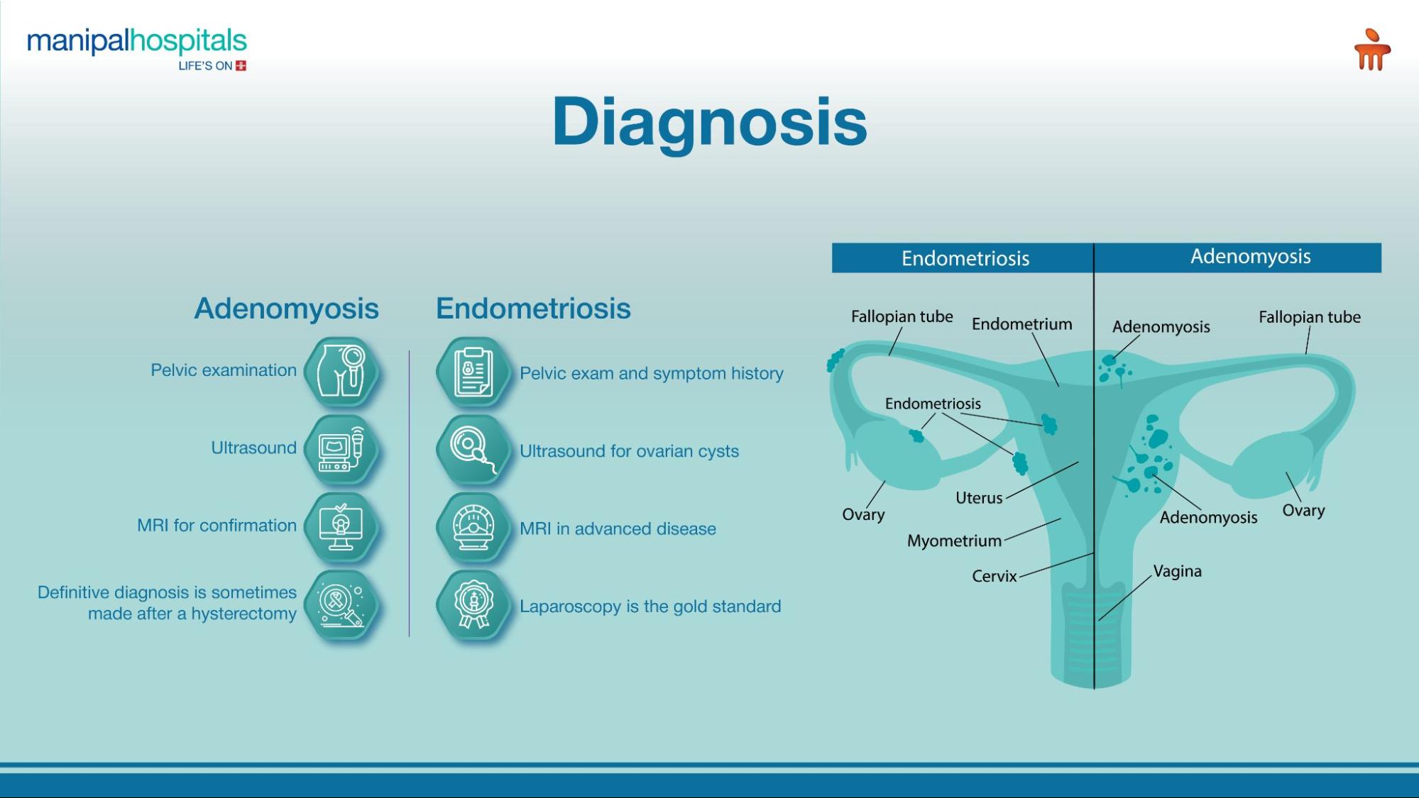 Adenomyosis treatment