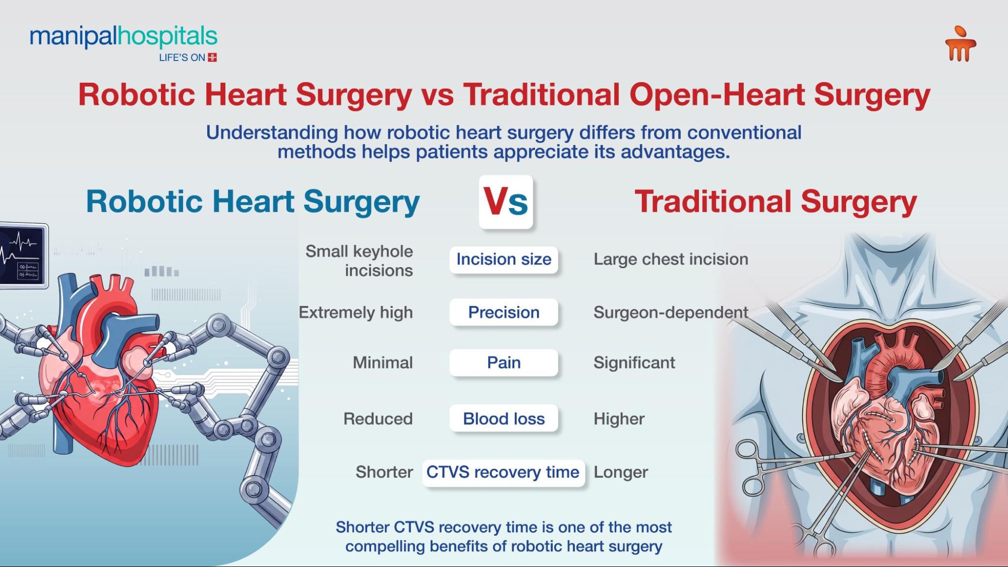 robotic heart surgery