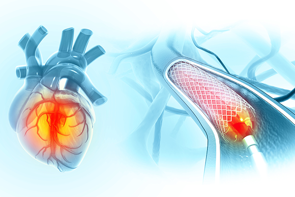 angioplasty-vs-bypass-surgery