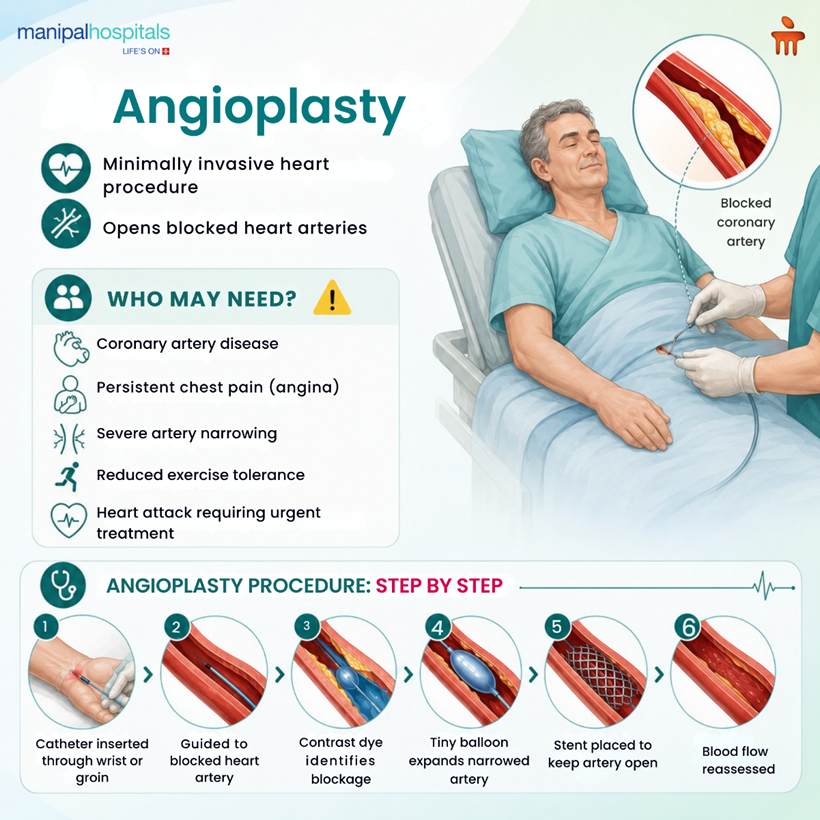Angioplasty Procedure Explained: What to Expect, Recovery, and Risks