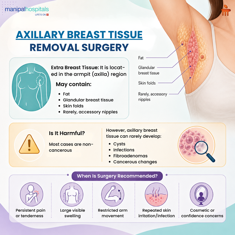 axillary breast removal surgery