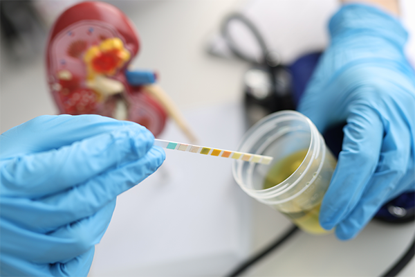 Blood in Urine (Hematuria): Possible Causes & When to See a Doctor