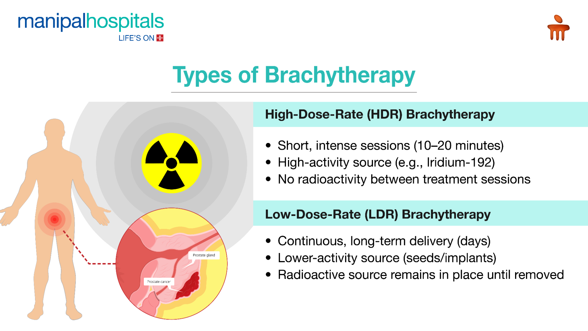 Brachytherapy for Cervical Cancer: How It Works & Benefits