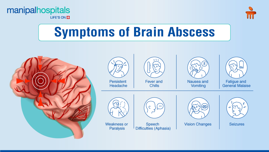 Brain Abscess