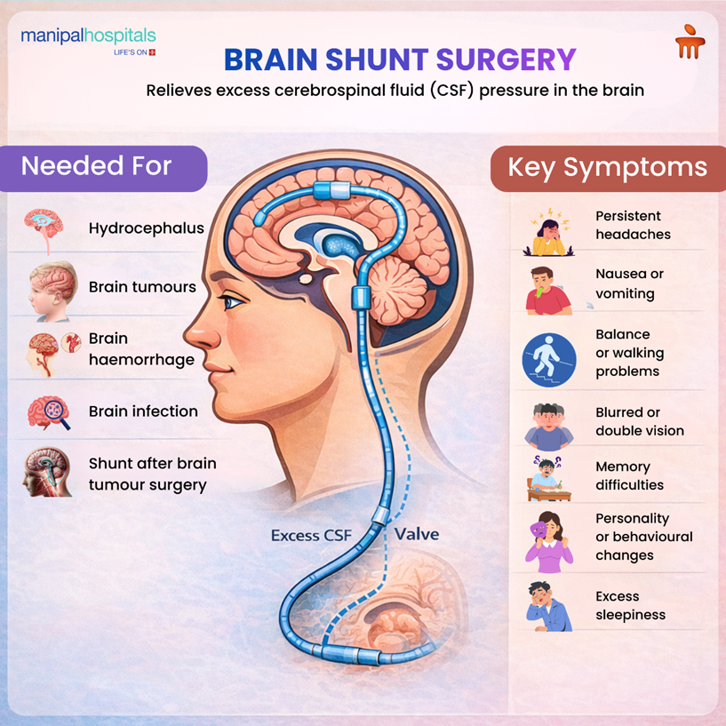 Brain shunt surgery procedure and recovery