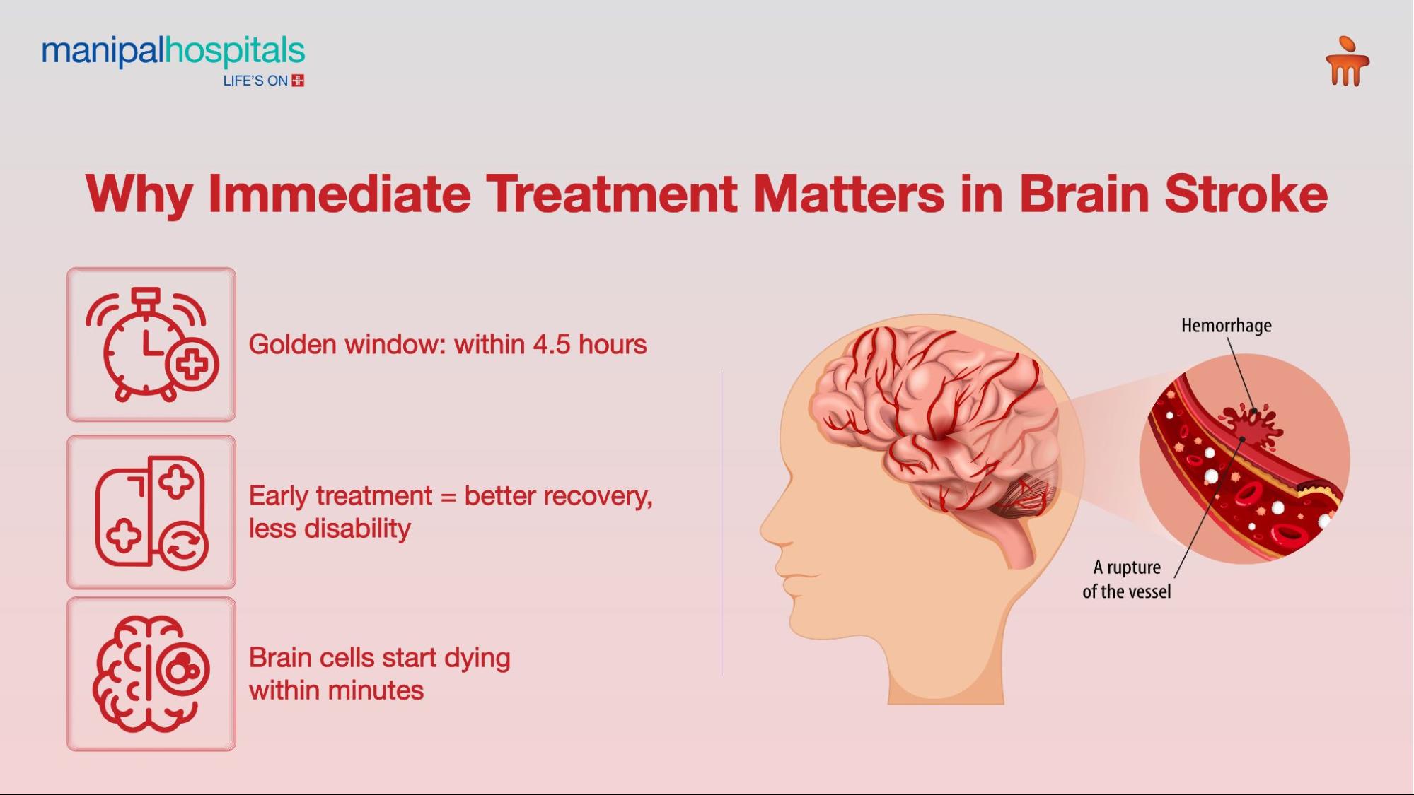 Brain stroke treatment clot removal and injection