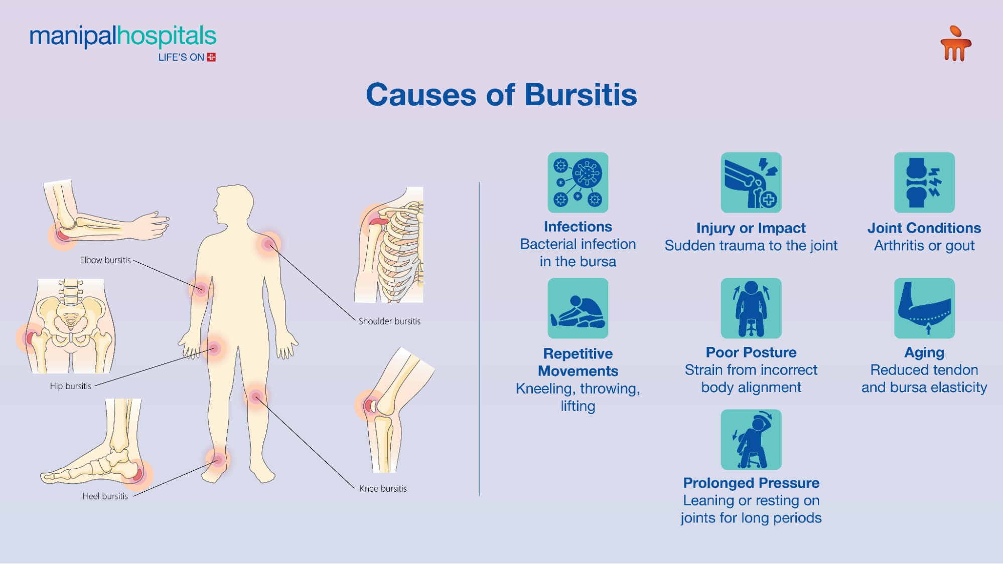 bursitis Symptoms