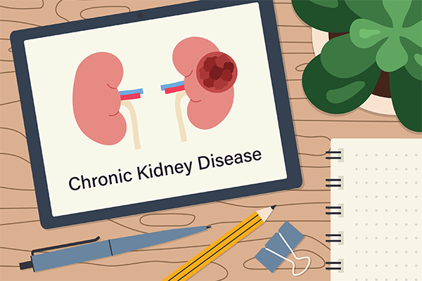 Chronic kidney disease