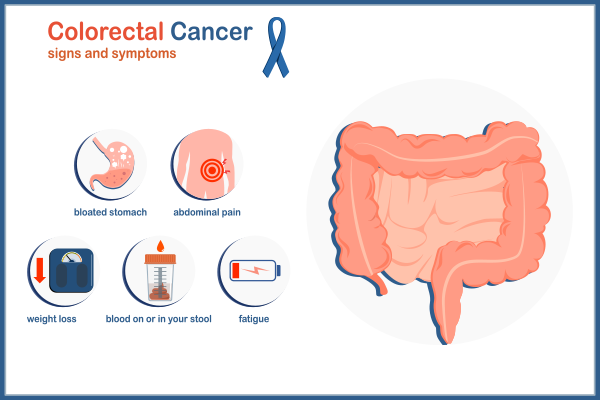 Colorectal Cancer in Young Adults