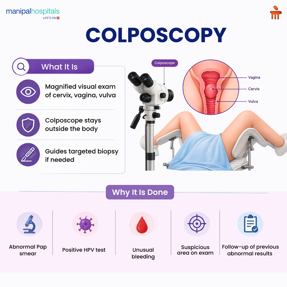 Colposcopy Procedure: What to Expect During a Colposcopy Test