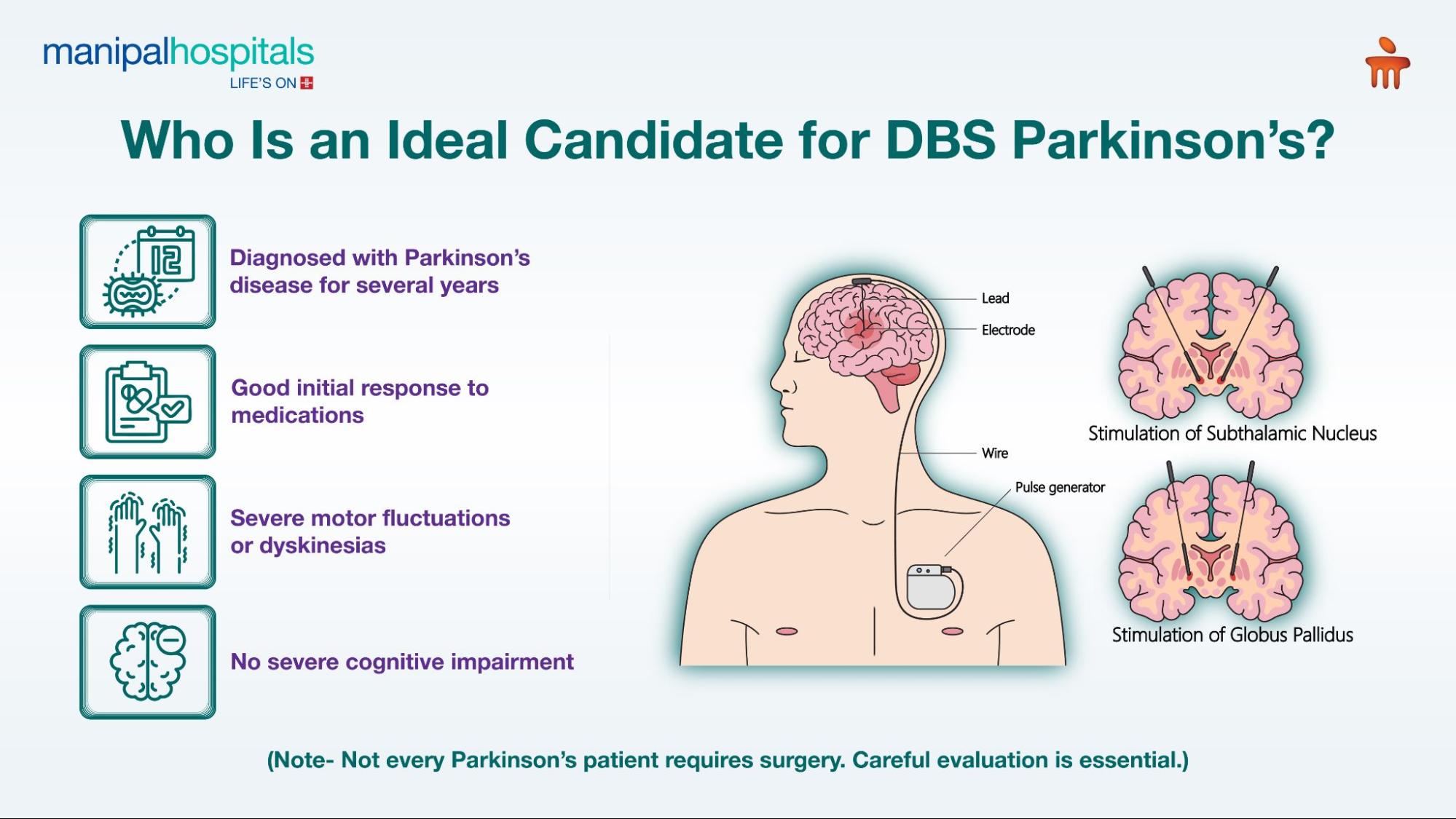 DBS Parkinson's Disease
